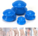 Cupping Therapy Set-Deal Finds Daily