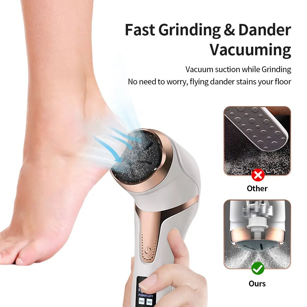 Electric Foot Callus Remover-Deal Finds Daily