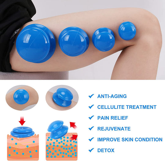 Cupping Therapy Set-Deal Finds Daily